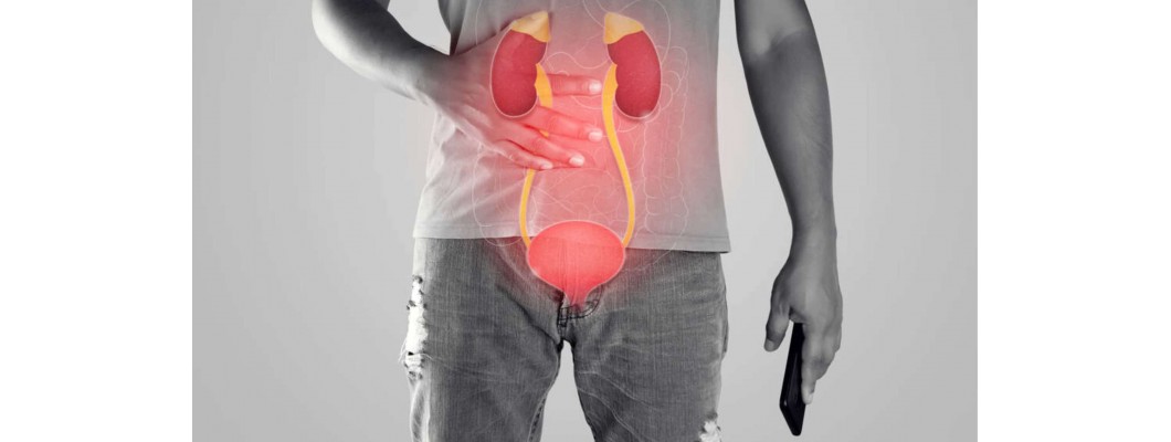 Top 5 Homeopathy Medicines For Kidney Stone Treatment