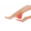 Homeopathic Medicine for Heel Pain